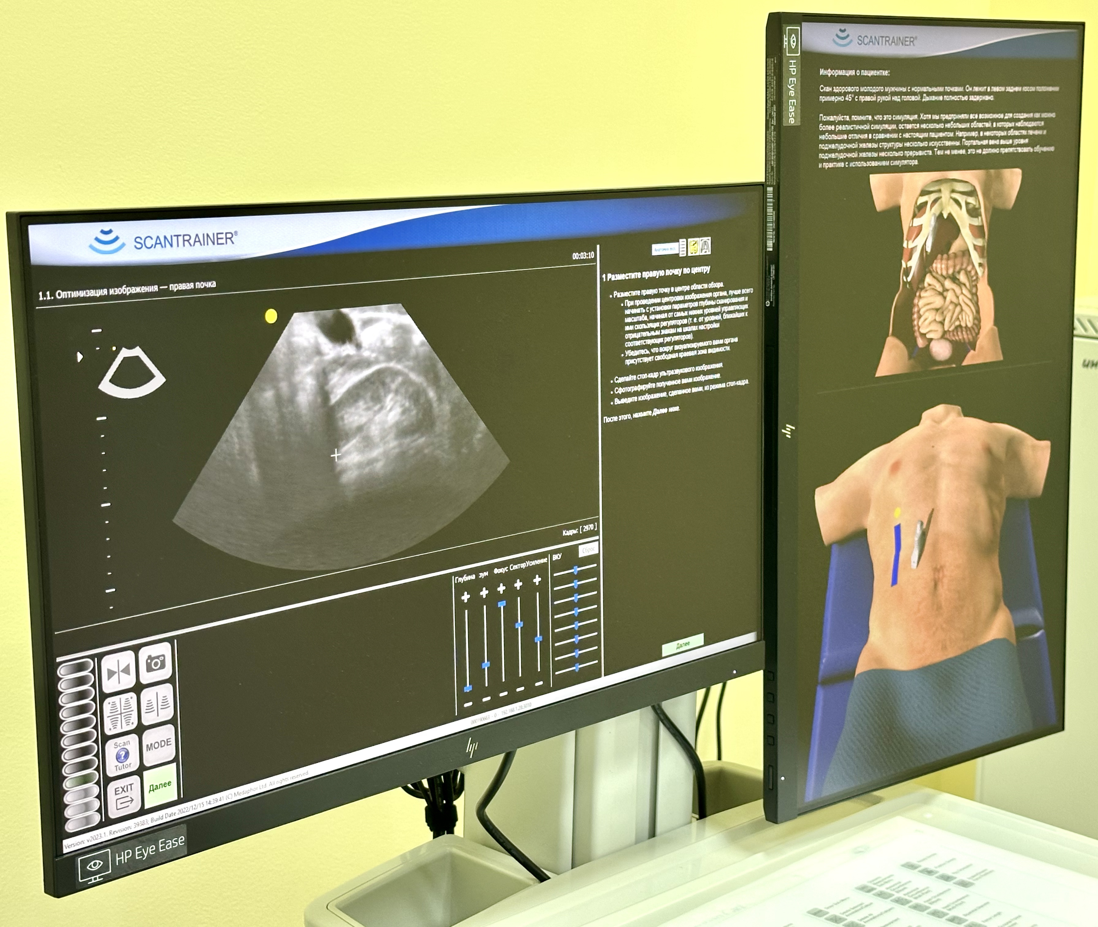 ырврвпапрпаррр